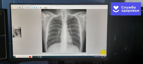 Тожуда чаа рентген аппарадын салган