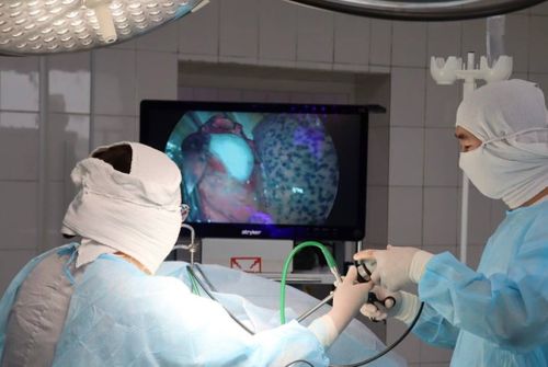 Идепкейлиг узун назын