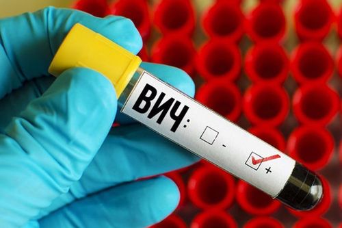 СПИД: бис ышкаш эвээш санныг чонга коргунчуг халап-тыр.