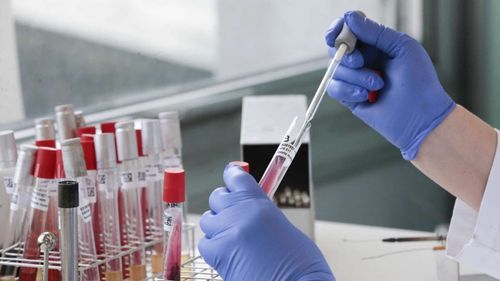 Ковид бо хүнде байдал-биле.