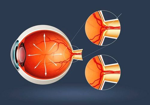 Эгезинде тодаргай демдектер чок.