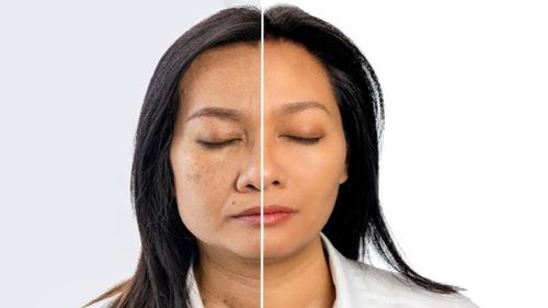 Тывада кадык камгалал төптери назылап кырыырының амы-хууда чылдагаанын шинчилээр